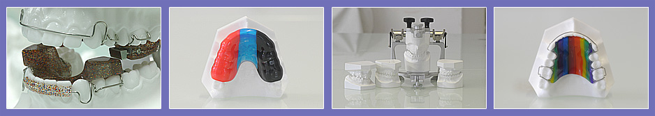 orthodontic appliances
